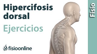 Ejercicio para eliminar por completo la hipercifosis dorsal [upl. by Alekim143]