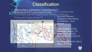 Pulmonary Hypertension A challenging cause of shortness of breath [upl. by Fasta930]