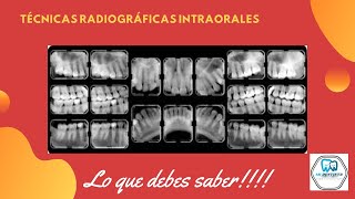 Técnicas Radiográficas Intraorales Periapical o Retroalveolar  Bite wing  oclusal [upl. by Kynthia]