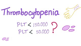 Thrombocytopenia  Why Is My Platelet Count Low [upl. by Ynohtna]