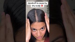 the key to perfectly healthy scalp 😳  hair growth tips youtubeshort hair hairgrowth [upl. by Nerrol198]