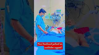 live treat patients on ventilator support ajeetsingh medical ki duniya short [upl. by Emmerie]