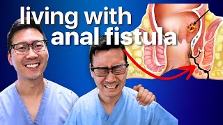 How to live with Anal Fistula [upl. by Edmunda486]