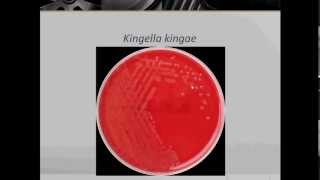 Bacteriology Gram Negative Coccobacilli Part 1 [upl. by Jermyn]