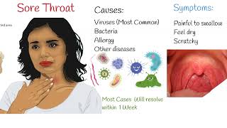 Sore Throat  Causes symptoms and management viral vs bacterial sore throat [upl. by Htirehc]