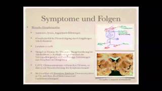 Sucht Alkohol Medikamente und Drogen Teil 88 [upl. by Eirrem]