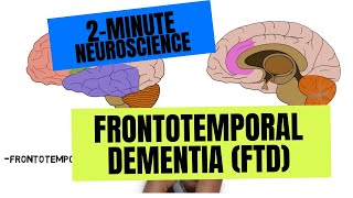 2Minute Neuroscience Frontotemporal Dementia FTD [upl. by Kir]