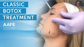 Full Face Botox Treatment  AAFE [upl. by Fanchet]