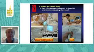 ISICEM Shock Tissue perfusion Jacques Creteur Brussels Belgium [upl. by Essex]