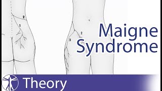 Thoracolumbar Syndrome  Maigne Syndrome [upl. by Neelhtak]