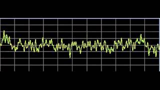 Vision Disorders  Rife Frequencies [upl. by Lionello165]