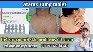 Atarax 10mg tablet use dose benefits and side effects full review in hindi [upl. by Dnaltroc]