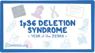 1p36 deletion syndrome Year of the Zebra [upl. by Poock]