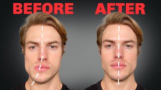 How to Fix Asymmetrical Jaw amp Face FOREVER [upl. by Ahsirkal150]