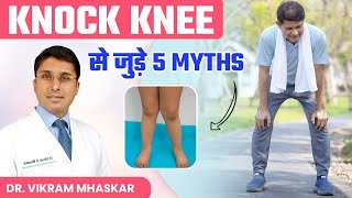 Exercise आपके knock knees को ठीक कर सकती है  Knock Knee से जुड़े 5 Myths  Dr Vikram Mhaskar [upl. by Aileve]