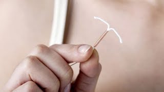 IUD most effective birth control option for teens Canadian pediatricians say [upl. by Narcho]