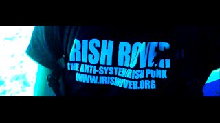 IRISH ROVER  IRISH PUNK ROCK MUSIC ANNOUCEMENT [upl. by Adnaram]