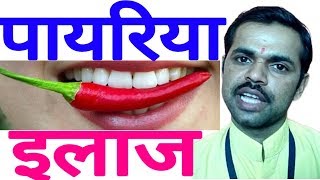 पायरिया का उपाय मुंह की बदबू का इलाज Payriya ilaj upay Treatment of Pyorrhea Dental Problems [upl. by Wearing]