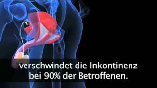 Für die Prostata ideal nach Prostataoperation [upl. by Aurelius458]