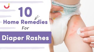 10 Effective Home Remedies For Diaper Rashes  Diaper Rash Symptoms Prevention and Treatment [upl. by Sinnej]