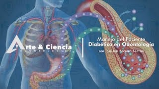 ►Manejo del Paciente Diabético en Odontología  DrJosé Luis Becerra Beltrán [upl. by Maridel715]