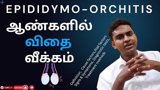 Epididymoorchitis Treatment in tamil ஆண்களின் விதை வீக்கம்  Signs amp Symptoms  Treatment methods [upl. by Huggins]