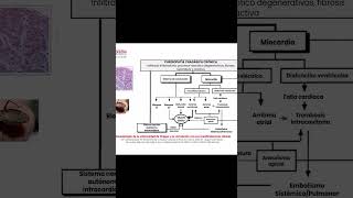 ¿Por qué la Cardiopatía Chagásica es Diferente Dr Alexander Alvarez [upl. by Keller449]