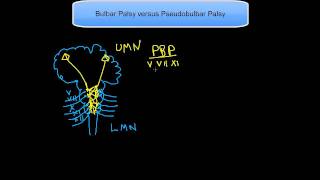 Bulbar Palsy versus Pseudobulbar Palsy [upl. by Fasto584]