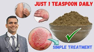 Just 1 Teaspoon Daily To Cure all Your Skin Problems  Eczema  Simple Treatment [upl. by Lladnew]