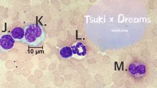 How To Do Differential White Blood Cell Count No Music [upl. by Caz]