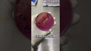 Escherichia coli 🧫🧫🧫 Bacteriologia microbiología [upl. by Derraj234]