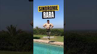 Esse marombeiro sofre de uma síndrome rara shorts [upl. by Aninaj]