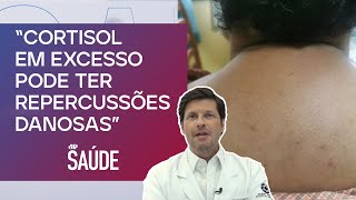 Quais causas e principais sintomas da síndrome de Cushing  Dr Filippo Pedrinola [upl. by Yonah391]