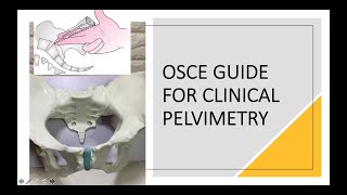 Clinical Pelvimetry [upl. by Olegnaed]