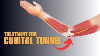 Can You Beat Cubital Tunnel Syndrome Discover Proven Treatment Tipsquot [upl. by Zenger93]