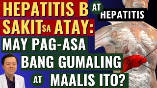 Hepatitis B at Sakit sa Atay May Pagasa bang Gumaling at Maalis Ito  By Doc Willie Ong [upl. by Ahsinotna]