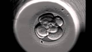 ivf embryo developing over 5 days by fertility Dr Raewyn Teirney [upl. by Nosauq]