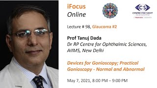 iFocus Online Session 98 Glaucoma 2 Gonioscopy [upl. by Caine]