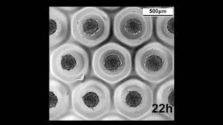 Mesenchymal Stem Cell spheroid formation time lapse [upl. by Assinna]