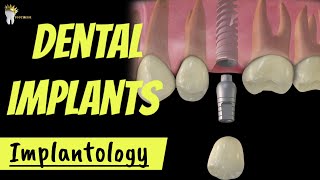 DENTAL IMPLANTS  INTRO and ADVANTAGES OSSEOINTEGRATION EXPLAINED [upl. by Nwahsear]