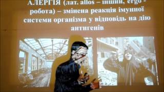 Патологія імунної системи Алергія [upl. by Aurore]