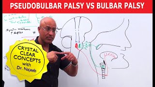 Pseudobulbar Palsy vs Bulbar Palsy [upl. by Aikemet39]