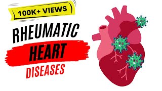 Rheumatic heart disease  Rheumatic fever [upl. by Meldoh]