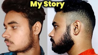 My Story Patchy Beard To Full Beard Naturally  Fix Patchy Beard Naturally  Beard Growth Reality 😯 [upl. by Funk]