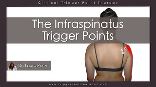 The Infraspinatus Trigger Points [upl. by Ahsoyem304]