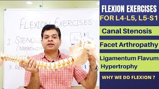 Flexion Exercises For Lumbar Canal Stenosis Facet Joint Arthropathy Ligamentum Flavum Hypertrophy [upl. by Narahs]