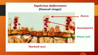 Taphrina deformans  Life Cycle By DrSmita Jain Associate Professor Botany [upl. by Napoleon868]