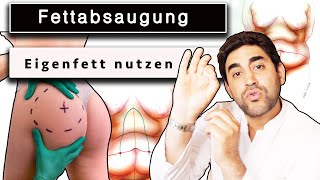 Unglaublich Fettabsaugung und das Fett nutzen  Lipofilling  Dr Alawi [upl. by Adnolor585]