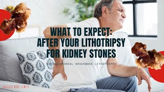 What to expect after your Lithotripsy procedure for Kidney Stones 2020  ESWL  Shockwave Therapy [upl. by Htinnek]