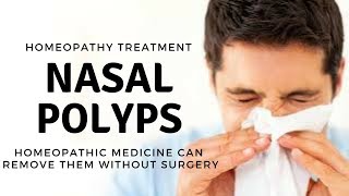 Nasal Polyps  CausesSymptoms amp Homeopathic Treatment in hindi [upl. by Elesig611]